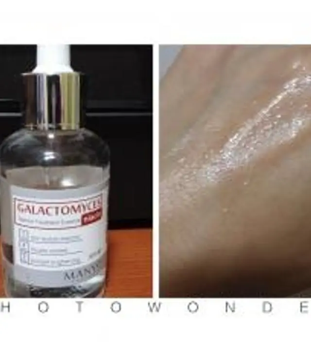 갈락토미 나이아신 에센스 50ml
