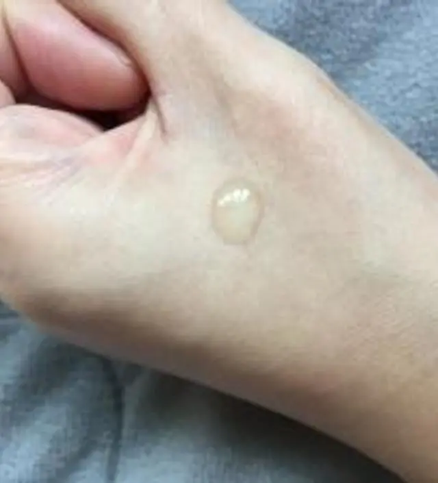 갈락토미 나이아신 에센스 50ml
