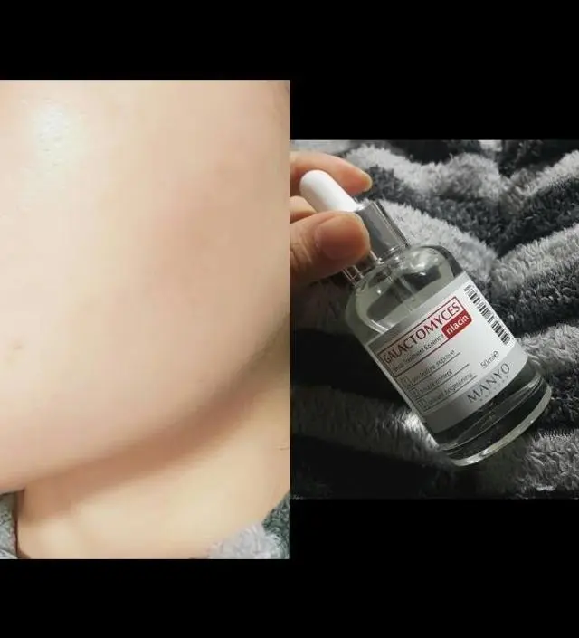 갈락토미 나이아신 에센스 50ml

