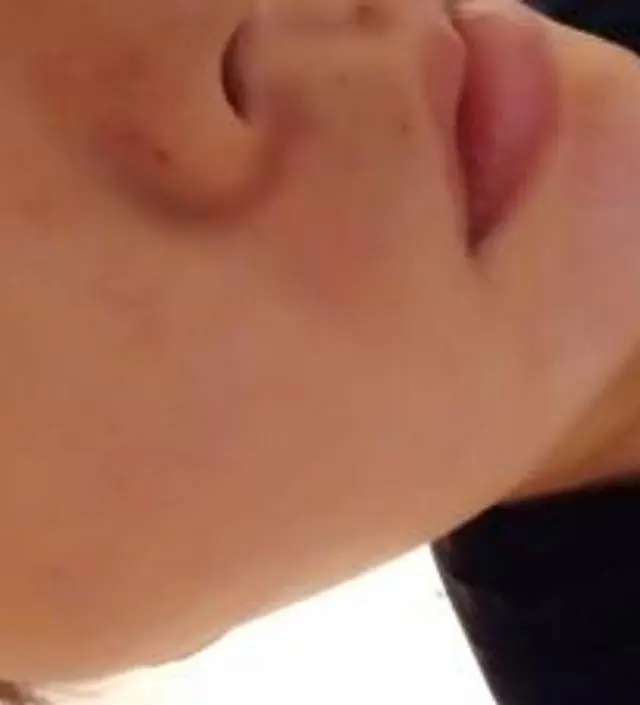 갈락토미 나이아신 에센스 50ml
