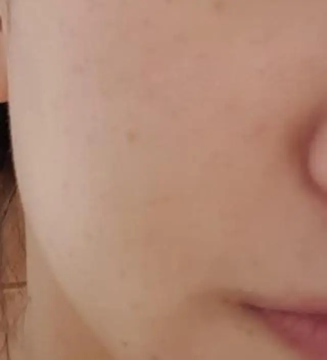 갈락토미 나이아신 에센스 50ml
