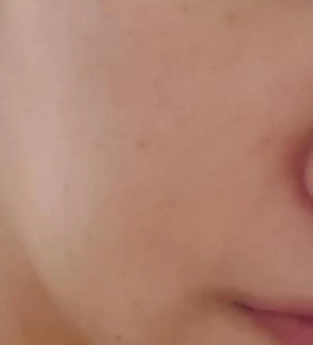 갈락토미 나이아신 에센스 50ml
