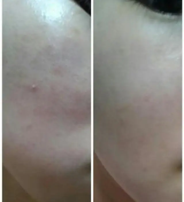 갈락토미 나이아신 에센스 50ml
