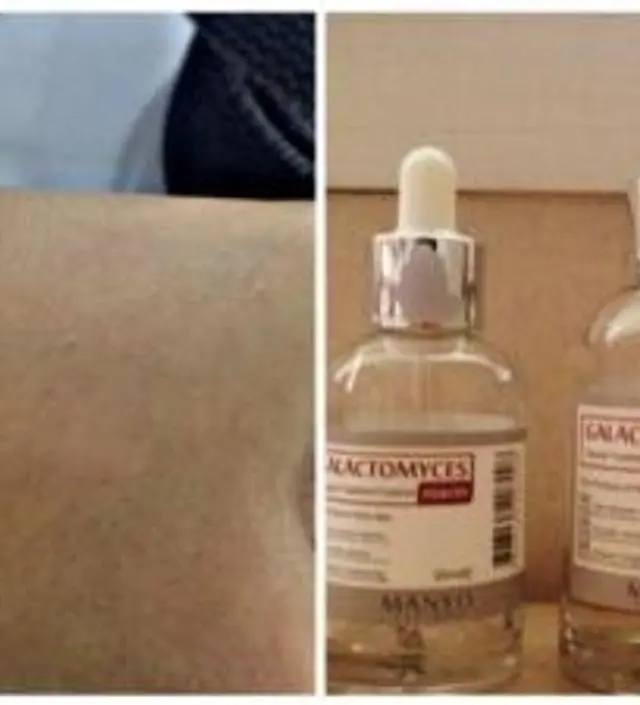 갈락토미 나이아신 에센스 50ml
