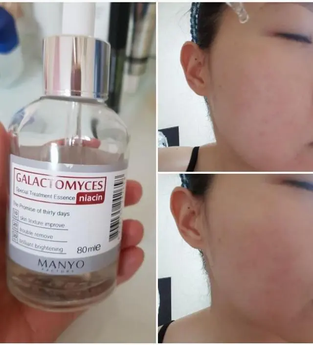 갈락토미 나이아신 에센스 50ml
