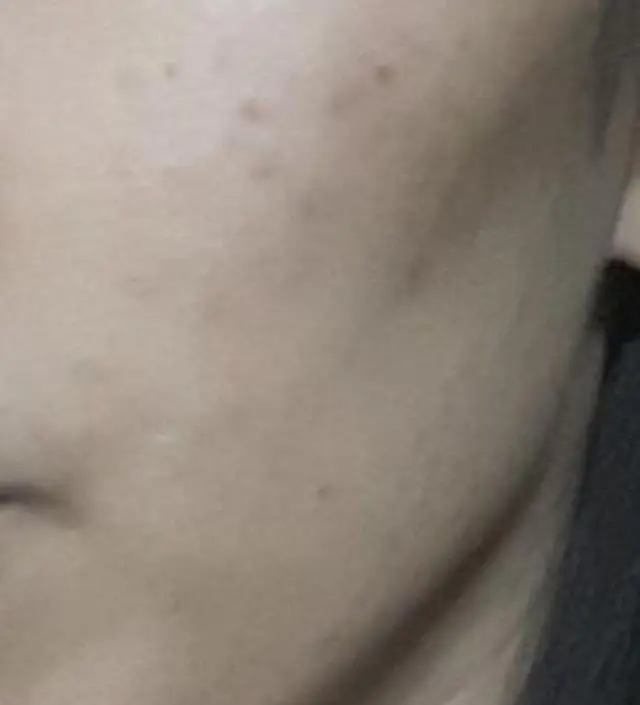 갈락토미 나이아신 에센스 50ml
