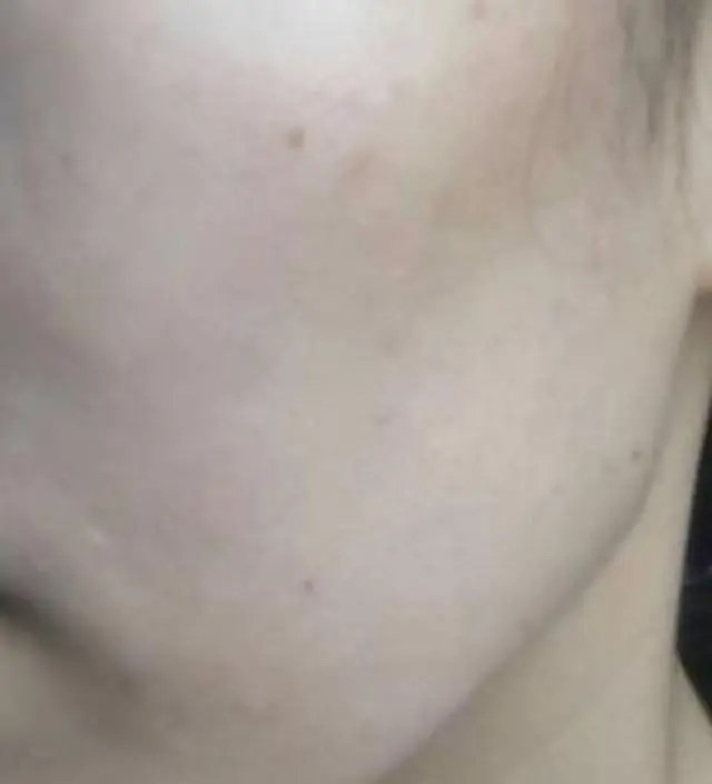 갈락토미 나이아신 에센스 50ml
