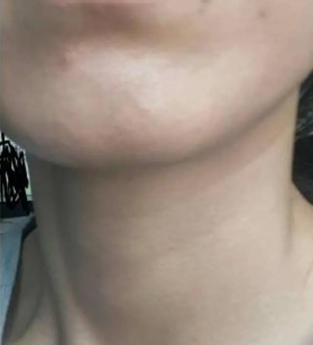 갈락토미 나이아신 에센스 50ml
