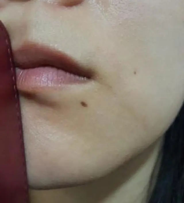 갈락토미 나이아신 에센스 50ml
