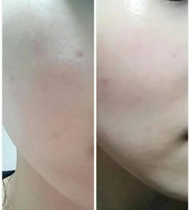 갈락토미 나이아신 에센스 50ml
