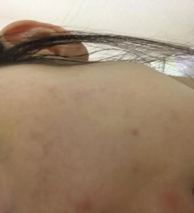 갈락토미 나이아신 에센스 50ml (+증정)
