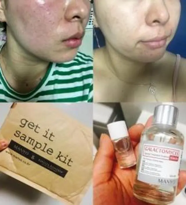 갈락토미 나이아신 에센스 50ml
