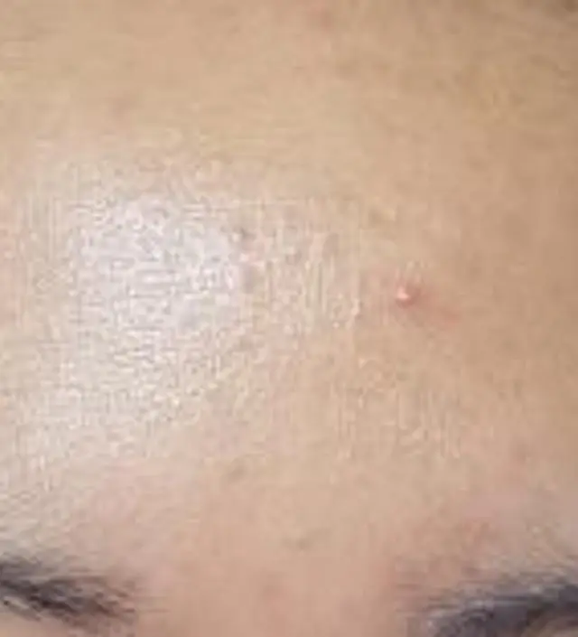 갈락토미 나이아신 에센스 50ml
