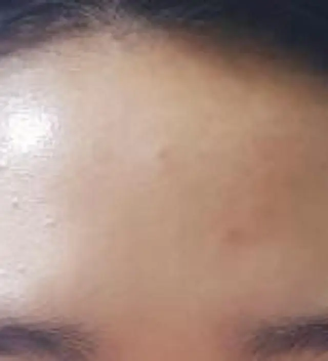 갈락토미 나이아신 에센스 50ml
