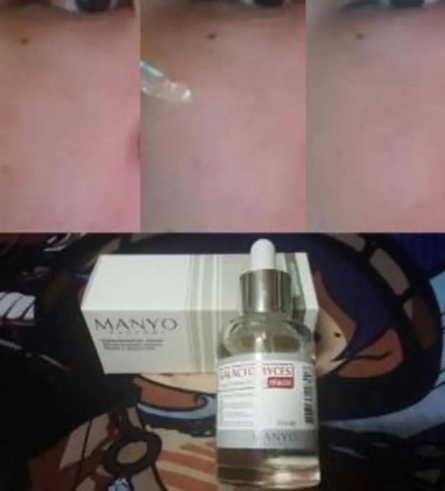 갈락토미 나이아신 에센스 50ml
