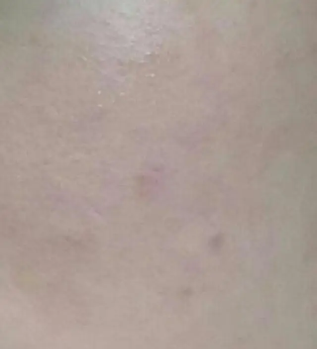 갈락토미 나이아신 에센스 50ml
