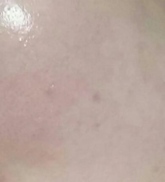 갈락토미 나이아신 에센스 50ml
