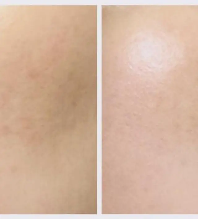 갈락토미 나이아신 에센스 50ml
