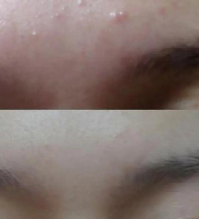 갈락토미 나이아신 에센스 50ml
