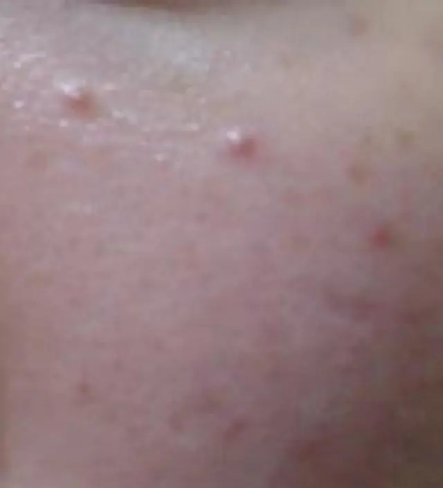 갈락토미 나이아신 에센스 50ml
