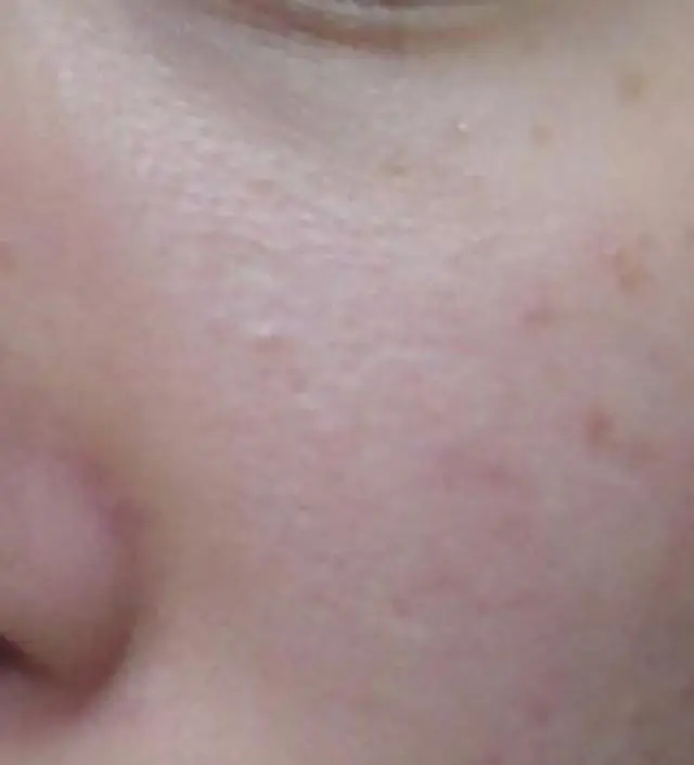 갈락토미 나이아신 에센스 50ml
