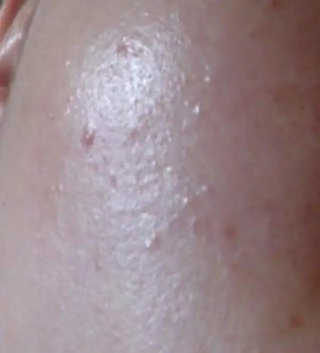 갈락토미 나이아신 에센스 50ml
