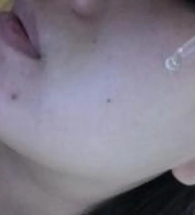 갈락토미 나이아신 에센스 50ml
