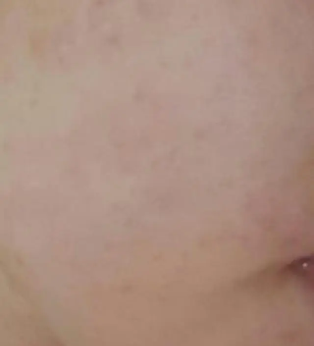 갈락토미 나이아신 에센스 50ml
