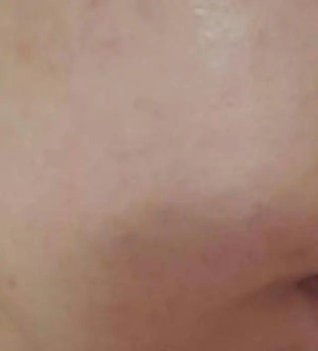 갈락토미 나이아신 에센스 50ml
