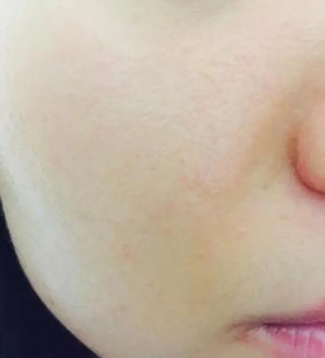 갈락토미 나이아신 에센스 50ml
