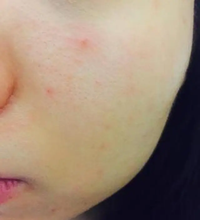 갈락토미 나이아신 에센스 50ml
