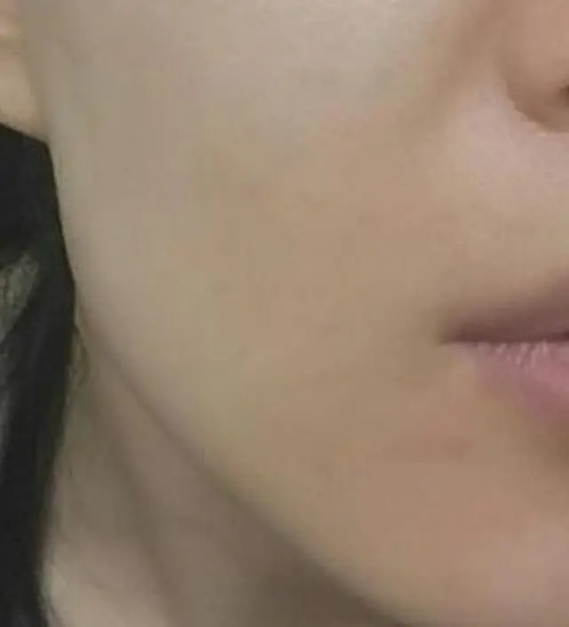 갈락토미 나이아신 에센스 50ml
