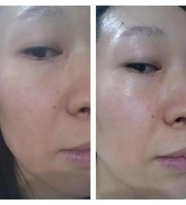 갈락토미 나이아신 에센스 50ml
