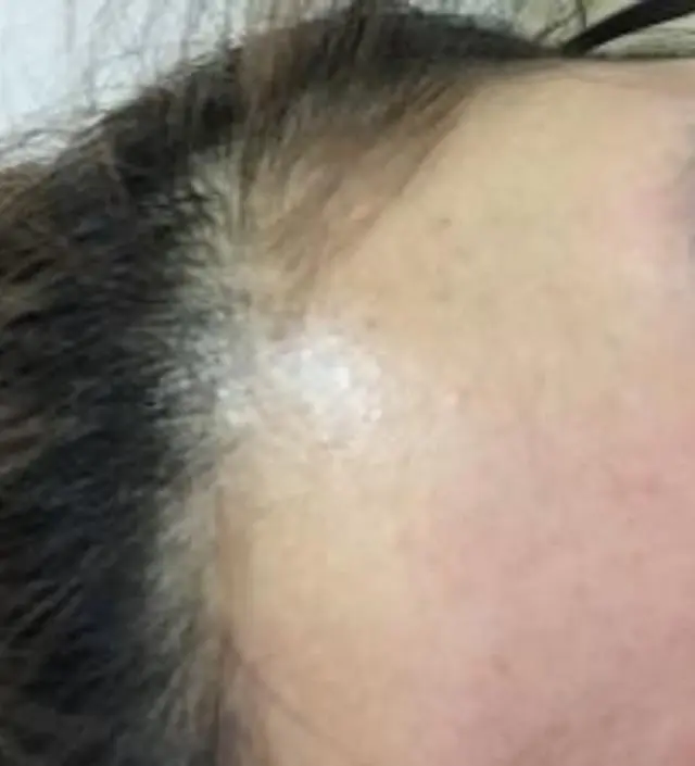 갈락토미 나이아신 에센스 50ml
