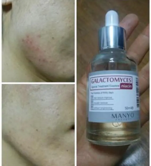 갈락토미 나이아신 에센스 50ml
