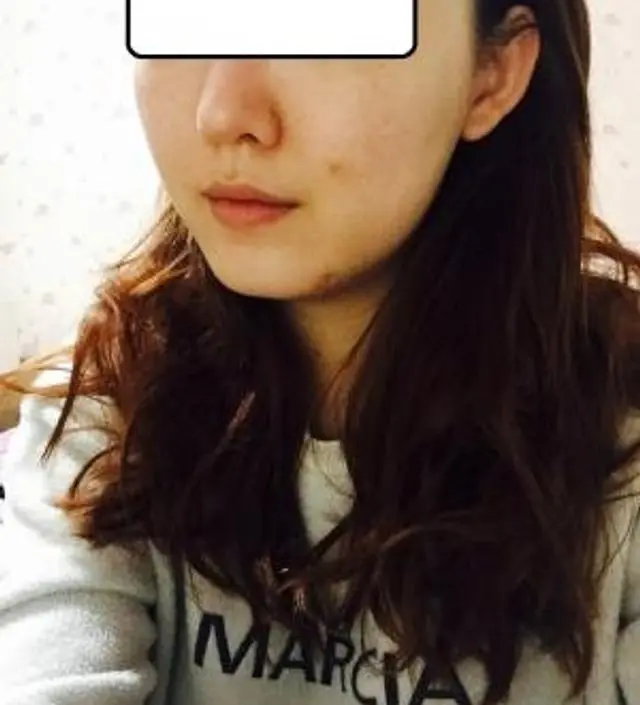 갈락토미 나이아신 에센스 50ml
