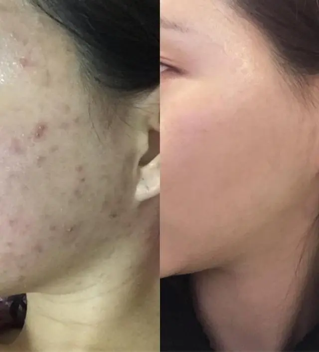 갈락토미 나이아신 에센스 50ml
