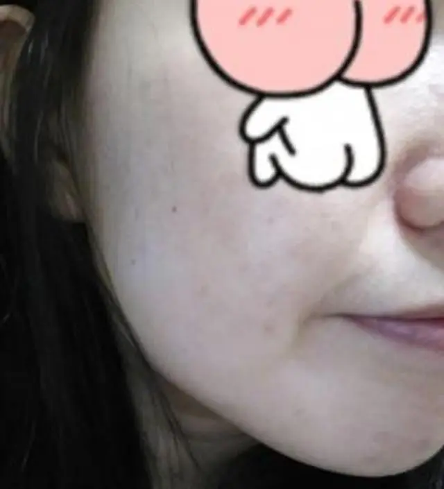 갈락토미 나이아신 에센스 50ml
