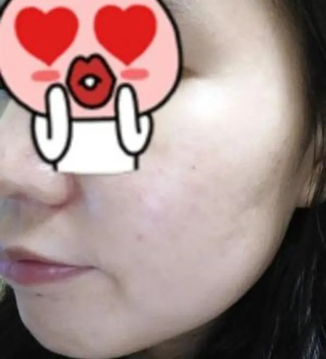 갈락토미 나이아신 에센스 50ml
