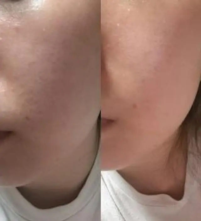 갈락토미 나이아신 에센스 50ml
