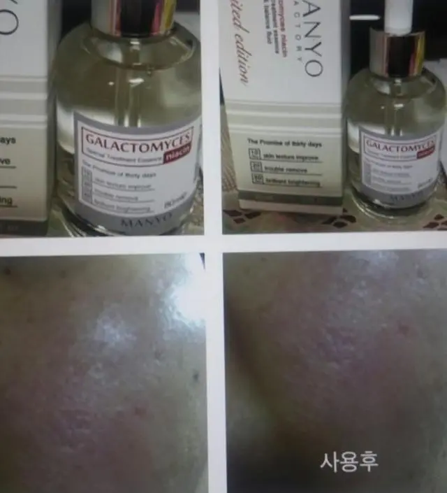 갈락토미 나이아신 에센스 50ml
