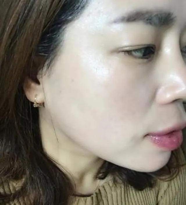 갈락토미 나이아신 에센스 50ml
