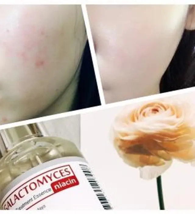 갈락토미 나이아신 에센스 50ml
