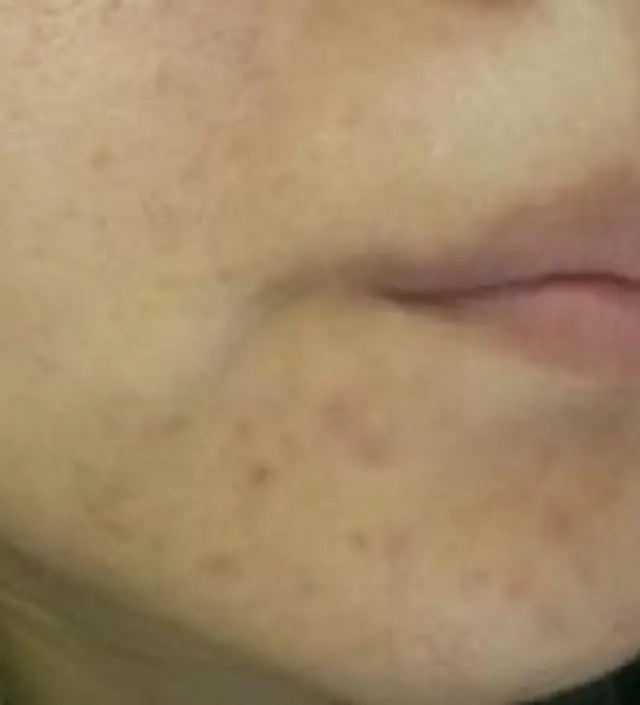 갈락토미 나이아신 에센스 50ml
