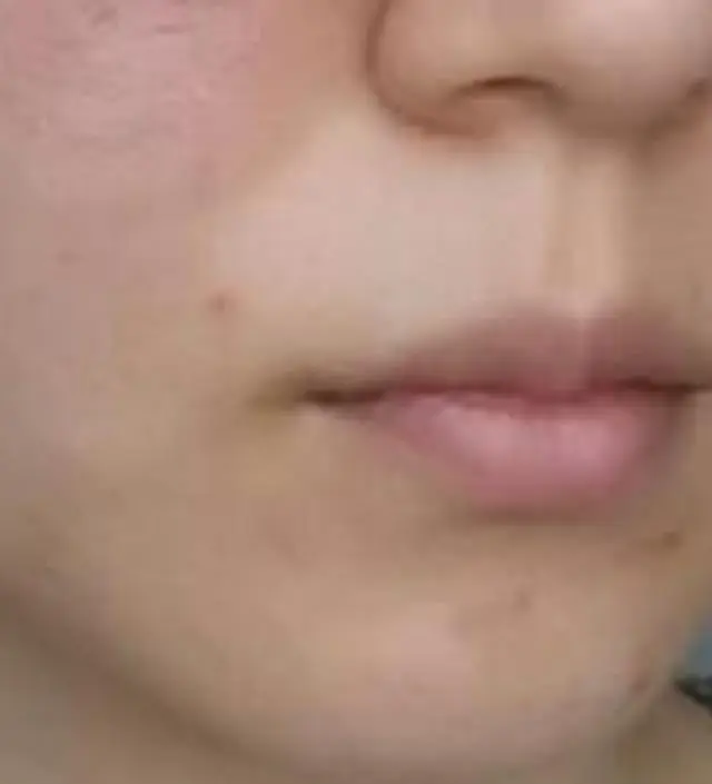 갈락토미 나이아신 에센스 50ml
