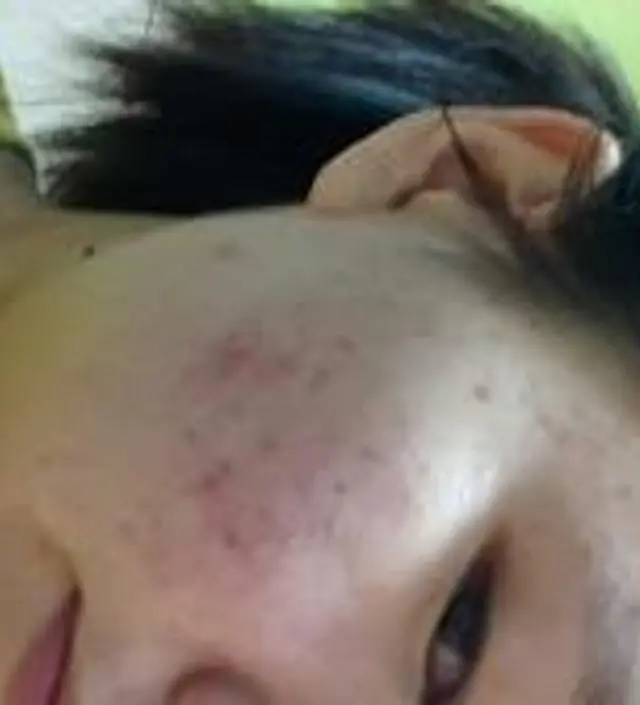 갈락토미 나이아신 에센스 50ml
