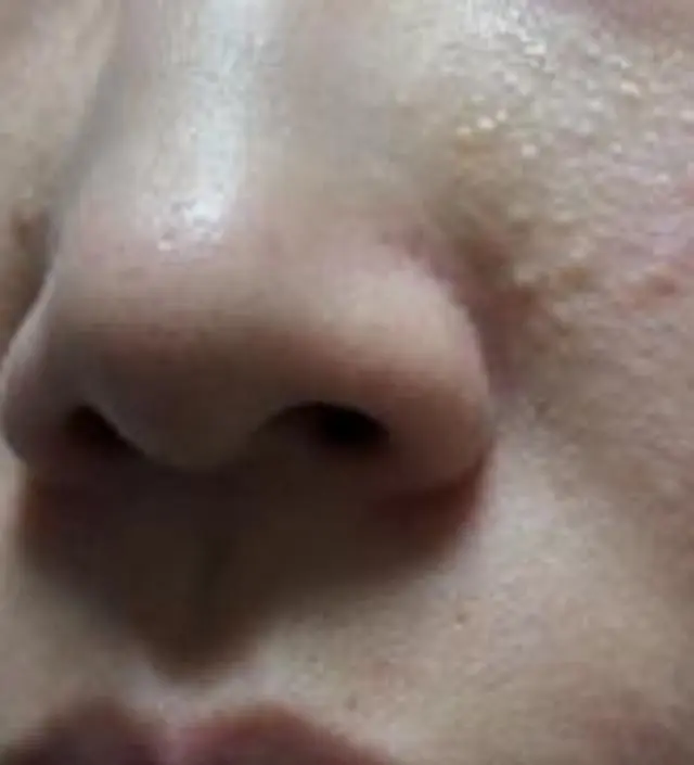 갈락토미 나이아신 에센스 50ml
