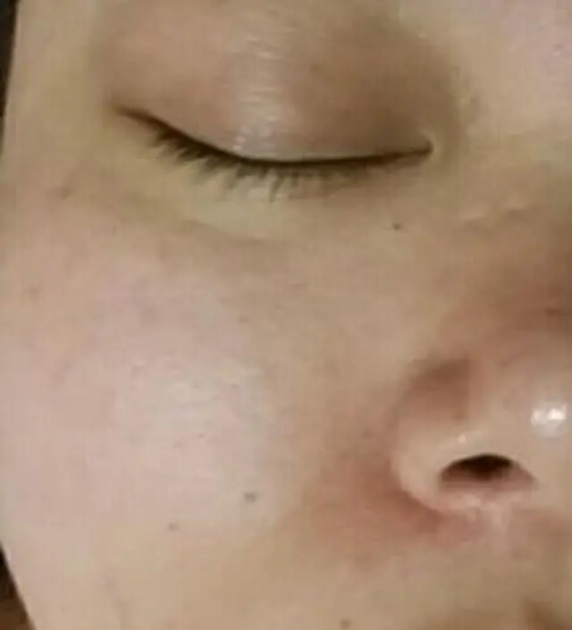 갈락토미 나이아신 에센스 50ml
