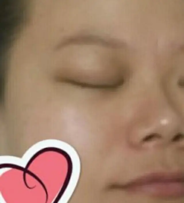 갈락토미 나이아신 에센스 50ml
