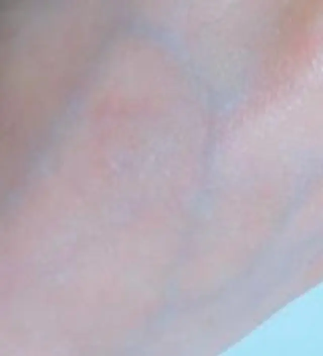 갈락토미 나이아신 에센스 50ml
